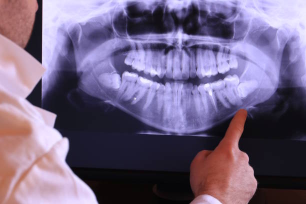 Best Dentist for Severe Toothache  in Marion, SC