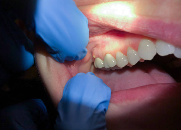 Best Urgent Tooth Repair  in Marion, SC
